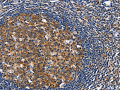 The image on the left is immunohistochemistry of paraffin-embedded Human tonsil tissue using the antibody Antibody) at dilution 1/40, on the right is treated with fusion protein. (Original magnification: ×200)Rabbit anti-Human CEP97 Polyclonal Antibody