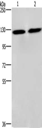 Gel: 6%SDS-PAGE, Lysate: 40 μg, Lane 1-2: PC3 cells, lovo cells, Primary antibody: CEP97 Antibody(CEP97 Antibody) at dilution 1/750, Secondary antibody: Goat anti rabbit IgG at 1/8000 dilution, Exposure time: 3 secondsRabbit anti-Human CEP97 Polyclonal Antibody