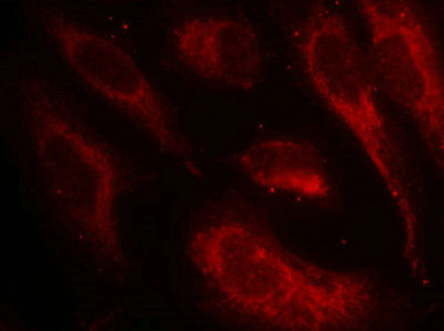 Immunofluorescence staining of methanol-fixed Hela cells using HSF1(Phospho-Ser307) Antibody.Rabbit anti-Human HSF1 Polyclonal Antibody
