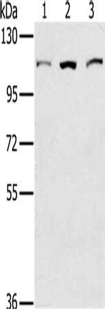 Gel: 6%SDS-PAGE, Lysate: 40 μg, Lane 1-3: K562 cells, 293T cells, hela cells, Primary antibody: KIF20A Antibody(KIF20A Antibody) at dilution 1/400, Secondary antibody: Goat anti rabbit IgG at 1/8000 dilution, Exposure time: 10 seconds