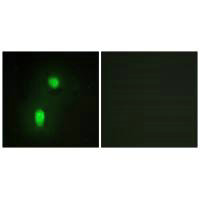 Immunofluorescence analysis of HUVEC cells, using hnRNP C1/C2 antibody.Rabbit anti-Human HNRNPC Polyclonal Antibody