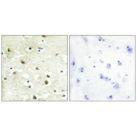 Immunohistochemistry analysis of paraffin-embedded human brain tissue using hnRNP C1/C2 antibody.Rabbit anti-Human HNRNPC Polyclonal Antibody