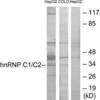 Western blot analysis of extracts from HepG2 cells and COLO205 cells, using hnRNP C1/C2 antibody.Rabbit anti-Human HNRNPC Polyclonal Antibody