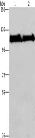 Gel: 6%SDS-PAGE, Lysate: 40 μg, Lane 1-2: Jurkat cells, Hela cells, Primary antibody: PARP1 Antibody(PARP1 Antibody) at dilution 1/200, Secondary antibody: Goat anti rabbit IgG at 1/8000 dilution, Exposure time: 10 secondsRabbit anti-Human PARP1 Polyclonal Antibody