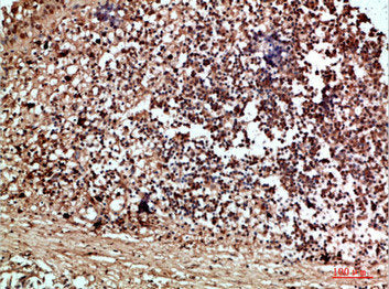 Immunohistochemical analysis of paraffin-embedded human-thyroid, antibody was diluted at 1:200Rabbit anti-Human RCC1 Polyclonal Antibody