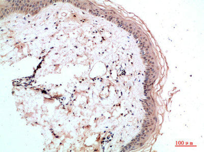 Immunohistochemical analysis of paraffin-embedded human-skin, antibody was diluted at 1:200Rabbit anti-Human RCC1 Polyclonal Antibody