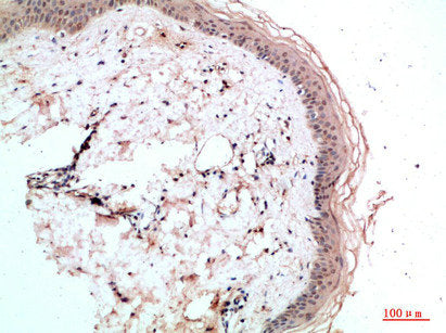 Immunohistochemical analysis of paraffin-embedded human-skin, antibody was diluted at 1:200Rabbit anti-Human RCC1 Polyclonal Antibody