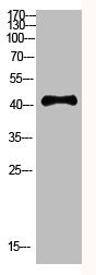 Western Blot analysis of HEPG2 cells using Antibody diluted at 800. Secondary antibody  was diluted at 1:20000Rabbit anti-Human RCC1 Polyclonal Antibody