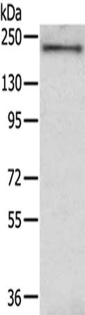 Gel: 6%SDS-PAGE,Lysate: 40 μg,,Primary antibody: IQGAP2 Antibody(IQGAP2 Antibody) at dilution 1/350 dilution,Secondary antibody: Goat anti rabbit IgG at 1/8000 dilution,Exposure time: 20 seconds