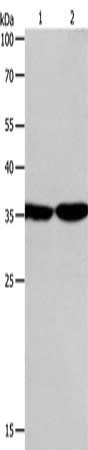 Gel: 10%SDS-PAGE, Lysate: 50 μg, Lane 1-2: NIH/3T3 cells, 231 cells, Primary antibody: PSMD14 Antibody(PSMD14 Antibody) at dilution 1/300, Secondary antibody: Goat anti rabbit IgG at 1/8000 dilution, Exposure time: 1 minuteRabbit anti-Human PSMD14 Polyclonal Antibody