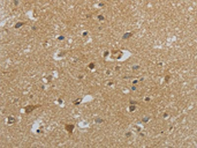 The image on the left is immunohistochemistry of paraffin-embedded Human brain tissue using the antibody Antibody) at dilution 1/40, on the right is treated with synthetic peptide. (Original magnification: ×200)Rabbit anti-Human NPHS1 Polyclonal Antibody