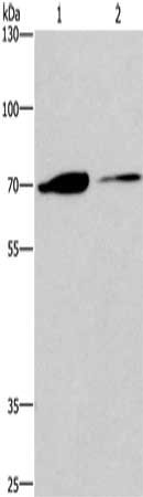 Gel: 8%SDS-PAGE, Lysate: 40 μg, Lane 1-2: 293T cells, mouse kidney tissue, Primary antibody: CROT Antibody(CROT Antibody) at dilution 1/270, Secondary antibody: Goat anti rabbit IgG at 1/8000 dilution, Exposure time: 5 minutesRabbit anti-Human CROT Polyclonal Antibody
