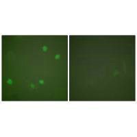 Immunofluorescence analysis of COS7 cells, using HDAC3 antibody.Rabbit anti-Human HDAC3 Polyclonal Antibody