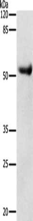 Gel: 10%SDS-PAGE, Lysate: 30 μg, Lane: Human liver cancer tissue, Primary antibody: DRD4 Antibody(DRD4 Antibody) at dilution 1/600, Secondary antibody: Goat anti rabbit IgG at 1/8000 dilution, Exposure time: 1 minuteRabbit anti-Human DRD4 Polyclonal Antibody