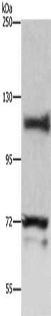 Gel: 8%SDS-PAGE, Lysate: 60 μg, Lane: Hela cells, Primary antibody: HIF1A Antibody(HIF1A Antibody) at dilution 1/500, Secondary antibody: Goat anti rabbit IgG at 1/8000 dilution, Exposure time: 10 minutesRabbit anti-Human HIF1A Polyclonal Antibody