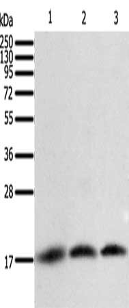 Gel: 12%SDS-PAGE, Lysate: 40 μg, Lane 1-3: A431 cells, Jurkat cells, hela cells, Primary antibody: BIRC5 Antibody(BIRC5 Antibody) at dilution 1/400, Secondary antibody: Goat anti rabbit IgG at 1/8000 dilution, Exposure time: 5 seconds