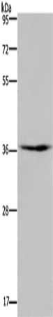 Gel: 8%SDS-PAGE, Lysate: 40 μg, Lane: Mouse skeletal muscle tissue, Primary antibody: PIM3 Antibody(PIM3 Antibody) at dilution 1/250, Secondary antibody: Goat anti rabbit IgG at 1/8000 dilution, Exposure time: 5 minutesRabbit anti-Human PIM3 Polyclonal Antibody