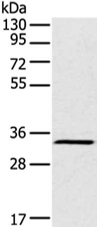 Gel: 8%SDS-PAGE, Lysate: 40 μg, Lane: Raji cell, Primary antibody: FOXR2 Antibody(FOXR2 Antibody) at dilution 1/200 dilution, Secondary antibody: Goat anti rabbit IgG at 1/8000 dilution, Exposure time: 2 minutesRabbit anti-Human FOXR2 Polyclonal Antibody