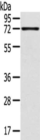 Gel: 8%SDS-PAGE,Lysate: 40 μg,,Primary antibody: TNIP1 Antibody(TNIP1 Antibody) at dilution 1/400 dilution,Secondary antibody: Goat anti rabbit IgG at 1/8000 dilution,Exposure time: 20 secondsRabbit anti-Human TNIP1 Polyclonal Antibody