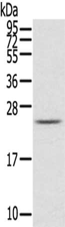 Gel: 12%SDS-PAGE,Lysate: 40 μg,,Primary antibody: RAB2A Antibody(RAB2A Antibody) at dilution 1/650 dilution,Secondary antibody: Goat anti rabbit IgG at 1/8000 dilution,Exposure time: 1 minuteRabbit anti-Human RAB2A Polyclonal Antibody