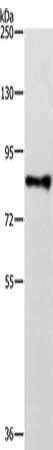 Gel: 8%SDS-PAGE, Lysate: 40 μg, Lane: Mouse thymus tissue, Primary antibody: TRAF3IP1 Antibody(TRAF3IP1 Antibody) at dilution 1/300, Secondary antibody: Goat anti rabbit IgG at 1/8000 dilution, Exposure time: 5 minutesRabbit anti-Human TRAF3IP1 Polyclonal Antibody