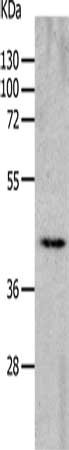 Gel: 10%SDS-PAGE, Lysate: 40 μg, Lane: Mouse heart tissue, Primary antibody: CHRNA7 Antibody(CHRFAM7A Antibody) at dilution 1/700, Secondary antibody: Goat anti rabbit IgG at 1/8000 dilution, Exposure time: 2 minutesRabbit anti-Human CHRNA7 Polyclonal Antibody