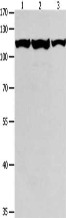 Gel: 8%SDS-PAGE, Lysate: 40 μg, Lane 1-3: K562 cells, Jurkat cells, hela cells, Primary antibody: MCM3 Antibody(MCM3 Antibody) at dilution 1/550, Secondary antibody: Goat anti rabbit IgG at 1/8000 dilution, Exposure time: 1 minute