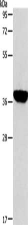 Gel: 10%SDS-PAGE, Lysate: 40 μg, Lane: Mouse liver tissue, Primary antibody: ALDOB Antibody(ALDOB Antibody) at dilution 1/200, Secondary antibody: Goat anti rabbit IgG at 1/8000 dilution, Exposure time: 2 secondsRabbit anti-Human ALDOB Polyclonal Antibody
