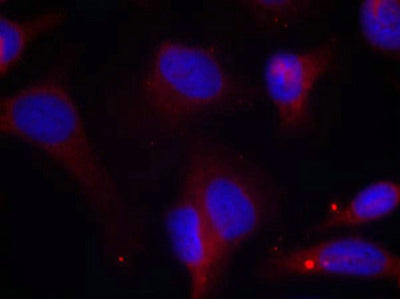 Immunofluorescence staining of methanol-fixed Hela cells using Zap-70(Phospho-Tyr319) Antibody.Rabbit anti-Human ZAP70 Polyclonal Antibody
