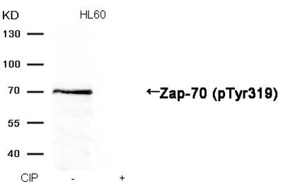 Western blot analysis of extracts from HL60 cells, treated with calf intestinal phosphatase (CIP), using Zap-70 (Phospho-Tyr319) Antibody.Rabbit anti-Human ZAP70 Polyclonal Antibody