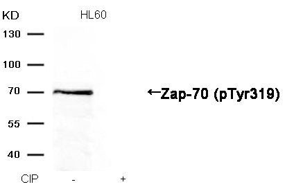 Western blot analysis of extracts from HL60 cells, treated with calf intestinal phosphatase (CIP), using Zap-70 (Phospho-Tyr319) Antibody.Rabbit anti-Human ZAP70 Polyclonal Antibody