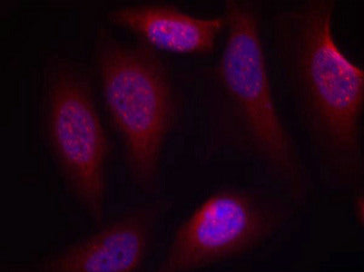 Immunofluorescence staining of methanol-fixed Hela cells using SEK1/MKK4(Phospho-Ser80) Antibody.