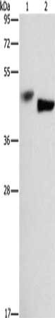 Gel: 8%SDS-PAGE, Lysate: 40 μg, Lane 1-2: A549 cells, hela cells, Primary antibody: BCL3 Antibody(BCL3 Antibody) at dilution 1/333, Secondary antibody: Goat anti rabbit IgG at 1/8000 dilution, Exposure time: 10 minutes