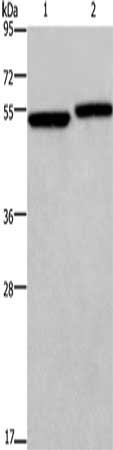 Gel: 8%SDS-PAGE, Lysate: 40 μg, Lane 1-2: Hela cells, 293T cells, Primary antibody: DDX19B Antibody(DDX19B Antibody) at dilution 1/300, Secondary antibody: Goat anti rabbit IgG at 1/8000 dilution, Exposure time: 20 secondsRabbit anti-Human DDX19B Polyclonal Antibody
