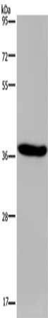 Gel: 8%SDS-PAGE, Lysate: 40 μg, Lane: LO2 cells, Primary antibody: KCNK17 Antibody(KCNK17 Antibody) at dilution 1/300, Secondary antibody: Goat anti rabbit IgG at 1/8000 dilution, Exposure time: 10 seconds