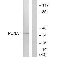 Western blot analysis of extracts from HepG2 cells, using PCNA antibody.Rabbit anti-Human PCNA Polyclonal Antibody