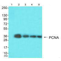 Western blot analysis of extracts from Hela cells (Lane 2), colo cells(Lane 3), HepG2 cells (Lane 4) and 293 cells (Lane 5) using PCNA antiobdy. The lane on the left is treated with synthesized peptide.Rabbit anti-Human PCNA Polyclonal Antibody