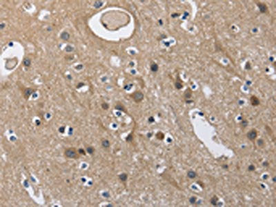 The image on the left is immunohistochemistry of paraffin-embedded Human brain  tissue using CD160 Antibody(CD160 Antibody) at dilution 1/60, on the right is treated with fusion protein. (Original magnification: ×200)Rabbit anti-Human CD160 Polyclonal Antibody