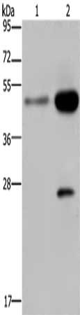 Gel: 10%SDS-PAGE, Lysate: 40 μg, Lane 1-2: 231 cells, Hela cells, Primary antibody: CD160 Antibody(CD160 Antibody) at dilution 1/300, Secondary antibody: Goat anti rabbit IgG at 1/8000 dilution, Exposure time: 40 secondsRabbit anti-Human CD160 Polyclonal Antibody