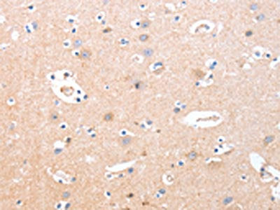 The image on the left is immunohistochemistry of paraffin-embedded Human brain  tissue using B3GAT1 Antibody(B3GAT1 Antibody) at dilution 1/40, on the right is treated with synthetic peptide. (Original magnification: ×200)