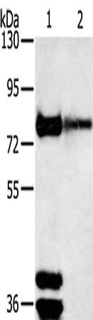 Gel: 6%SDS-PAGE, Lysate: 40 μg, Lane 1-2: Mouse brain tissue, human fetal brain tissue, Primary antibody: TRIM3 Antibody(TRIM3 Antibody) at dilution 1/200, Secondary antibody: Goat anti rabbit IgG at 1/8000 dilution, Exposure time: 10 minutesRabbit anti-Human TRIM3 Polyclonal Antibody