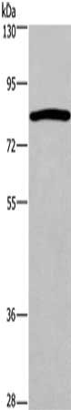 Gel: 6%SDS-PAGE, Lysate: 50 μg, Lane: Hela cells, Primary antibody: CHUK Antibody(CHUK Antibody) at dilution 1/200, Secondary antibody: Goat anti rabbit IgG at 1/8000 dilution, Exposure time: 5 minutesRabbit anti-Human CHUK Polyclonal Antibody