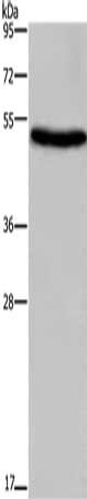 Gel: 8%SDS-PAGE, Lysate: 40 μg, Lane: Mouse skin tissue, Primary antibody: EIF3F Antibody(EIF3F Antibody) at dilution 1/250, Secondary antibody: Goat anti rabbit IgG at 1/8000 dilution, Exposure time: 40 secondsRabbit anti-Human EIF3F Polyclonal Antibody
