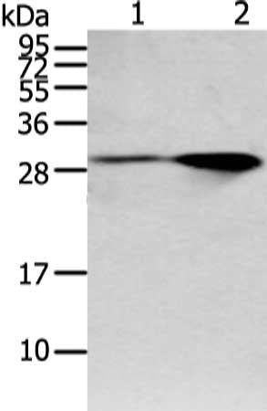 Gel: 12%SDS-PAGE, Lysate: 40 μg, Lane 1-2: Mouse brain and human fetal brain tissue, Primary antibody: SPIN4 Antibody(SPIN4 Antibody) at dilution 1/200 dilution, Secondary antibody: Goat anti rabbit IgG at 1/8000 dilution, Exposure time: 1 minuteRabbit anti-Human SPIN4 Polyclonal Antibody