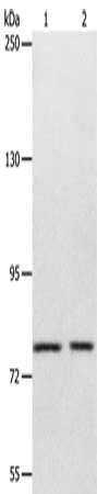 Gel: 8%SDS-PAGE, Lysate: 40 μg, Lane 1-2: Mouse liver tissue, SP20 cells, Primary antibody: ABCB6 Antibody(ABCB6 Antibody) at dilution 1/320, Secondary antibody: Goat anti rabbit IgG at 1/8000 dilution, Exposure time: 1 minute
