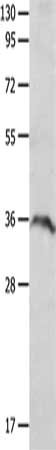 Gel: 10%SDS-PAGE, Lysate: 40 μg, Lane: Mouse spleen tissue, Primary antibody: P2RY6 Antibody(P2RY6 Antibody) at dilution 1/650, Secondary antibody: Goat anti rabbit IgG at 1/8000 dilution, Exposure time: 1 minuteRabbit anti-Human P2RY6 Polyclonal Antibody