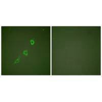 Immunofluorescence analysis of NIH/3T3 cells, using HSP10 antibody.Rabbit anti-Human HSPE1 Polyclonal Antibody