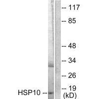 Western blot analysis of extracts from NIH/3T3 cells, using HSP10 antibody.Rabbit anti-Human HSPE1 Polyclonal Antibody