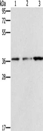 Gel: 10%SDS-PAGE, Lysate: 40 μg, Lane 1-3: Mouse liver tissue, A172 cells, human prostate tissue, Primary antibody: NDNL2 Antibody(NDNL2 Antibody) at dilution 1/1500, Secondary antibody: Goat anti rabbit IgG at 1/8000 dilution, Exposure time: 1 minuteRabbit anti-Human NDNL2 Polyclonal Antibody