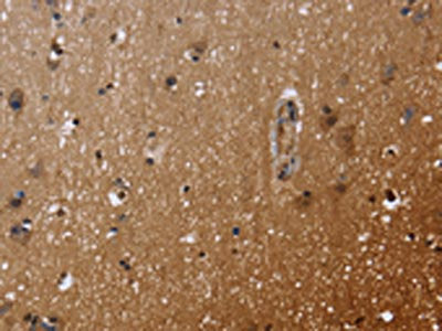 The image on the left is immunohistochemistry of paraffin-embedded Human brain tissue using FHL3 Antibody(FHL3 Antibody) at dilution 1/40. (Original magnification: ×200)Rabbit anti-Human FHL3 Polyclonal Antibody
